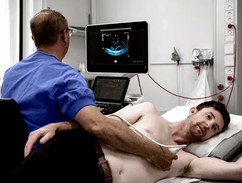 Echocardiography