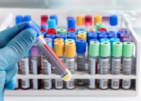 Laboratory Tests