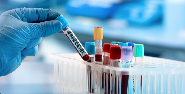 Blood testing service