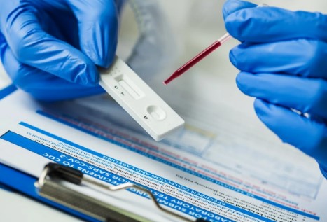Serological testing